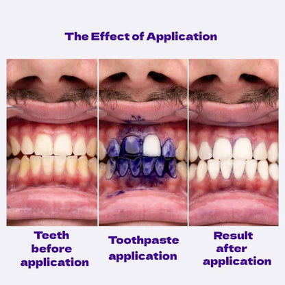 V34 Colour Corrector Toothpaste®